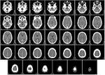 File:Computed <b>tomography</b> of