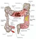 about <b>Colonic Diseases</b> and