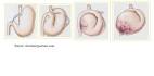 Bloat / Gastric Torsion « Back Alley Soapbox