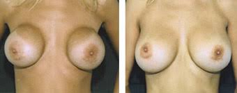 http://t2.gstatic.com/images?q=tbn:ANd9GcTj60yK1iIfXq9eVH7uO_x2RAzQaorHcI81LKHtW_ODScT45dC1FQ