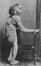 Elephant Man