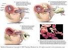 Survivors - Educate Yourself - First Trimester Abortion Procedures