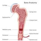 A <b>bone marrow</b> transplant is a