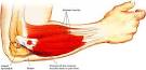 I figured it was <b>tennis elbow</b>,
