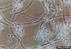white muscadine disease, Beauveria bassiana (Incertae sedis ...