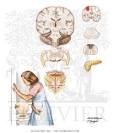 Detrusor Instability and Hyperreflexia - Netter Medical Artwork