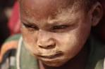 15. Somalian refugees wait in
