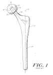 Coated load bearing surface for a prosthetic joint - Patent 0864303