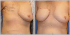 http://t2.gstatic.com/images?q=tbn:ANd9GcToMIWfAdtzoccRr8tMLs5S98dGYGjS9pUsowqQBCslm5ZqwfwgiLT-AJkt