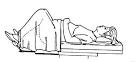 Lithotomy position. Causes, symptoms, treatment Lithotomy position