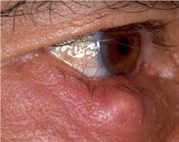 http://t2.gstatic.com/images?q=tbn:ANd9GcTpFoHPFW48AZvOYDhv6UzLqn9aK1DiDWbfUHDEwH6oHcgyfF4&t=1&usg=__pidQzDFm7AvG9h_uEDcuEHpvA80=