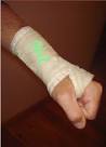 I Signed the Cast, Have You? | Ranch Ramblins