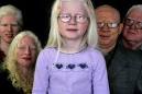 ... Samantha Hall, Jake Epelle and Allen Little know that stereotypes abound ... - 470_albino_air