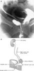 <b>urogenital abnormality</b>.