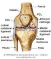 TORN CARTILAGE (