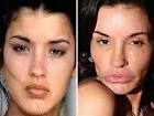 Plastic Surgery Gone WTF