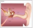 Labyrinthitis - symptoms, Definition, Description, Demographics ...