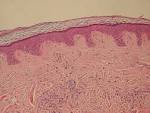 Epidermis and <b>dermis</b> of human