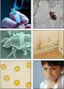 Allergens &amp; Irritants