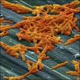 C Diff Symptoms – Signs if You're Suffering from C Diff Infection ...
