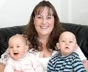 Superfetation. Causes, symptoms, treatment Superfetation