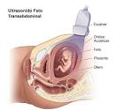 <b>Acondroplasia</b>