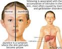 Bilirubin - definition, values / levels | Health Dictionary