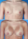 Breast Enhancement Pills   The Best Way To Pick The Best One
