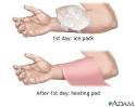 http://www.nlm.nih.gov/medlineplus/ency/images/ency/fullsize/9139.jpg