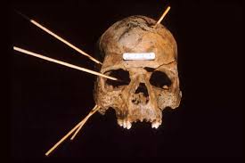 Forensic Anthropology