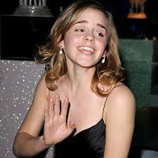 Emma Watson up skirt