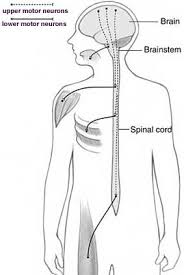 ALS Motor Neuron Diagram