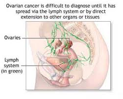 Warning Signs Of Ovarian