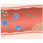 Septicemia