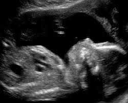 OB/Gyn