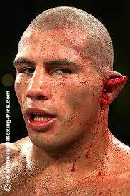 And Margarito wasnt just