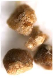 Kidney stones - Medicalook