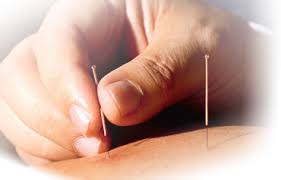 Acupunctura 2 Acupunctura 2