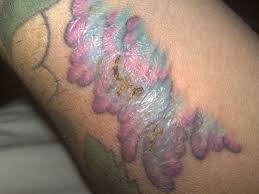 tattoo healing