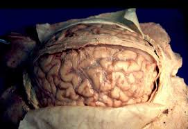 human brain image
