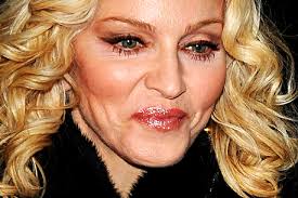 eyelid droop