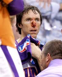 Steve Nash