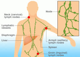 Lymphoma-cancer