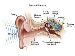 a cochlear implant.