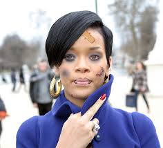 rihanna beat up pictures