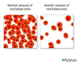 http://t2.gstatic.com/images?q=tbn:chEqpoWjHtzCyM:http://www.daviddarling.info/images/anemia_red_blood_cells.jpg&t=1
