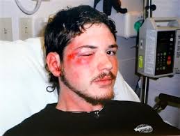 Justin Barker in the hospital.