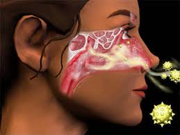 SinusPollenLarge Sinusitis And Allergies