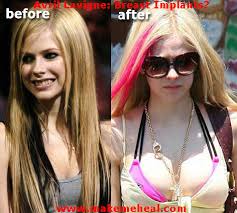 avril lavigne married