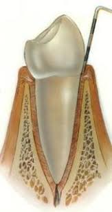 periodoncia Periodoncia